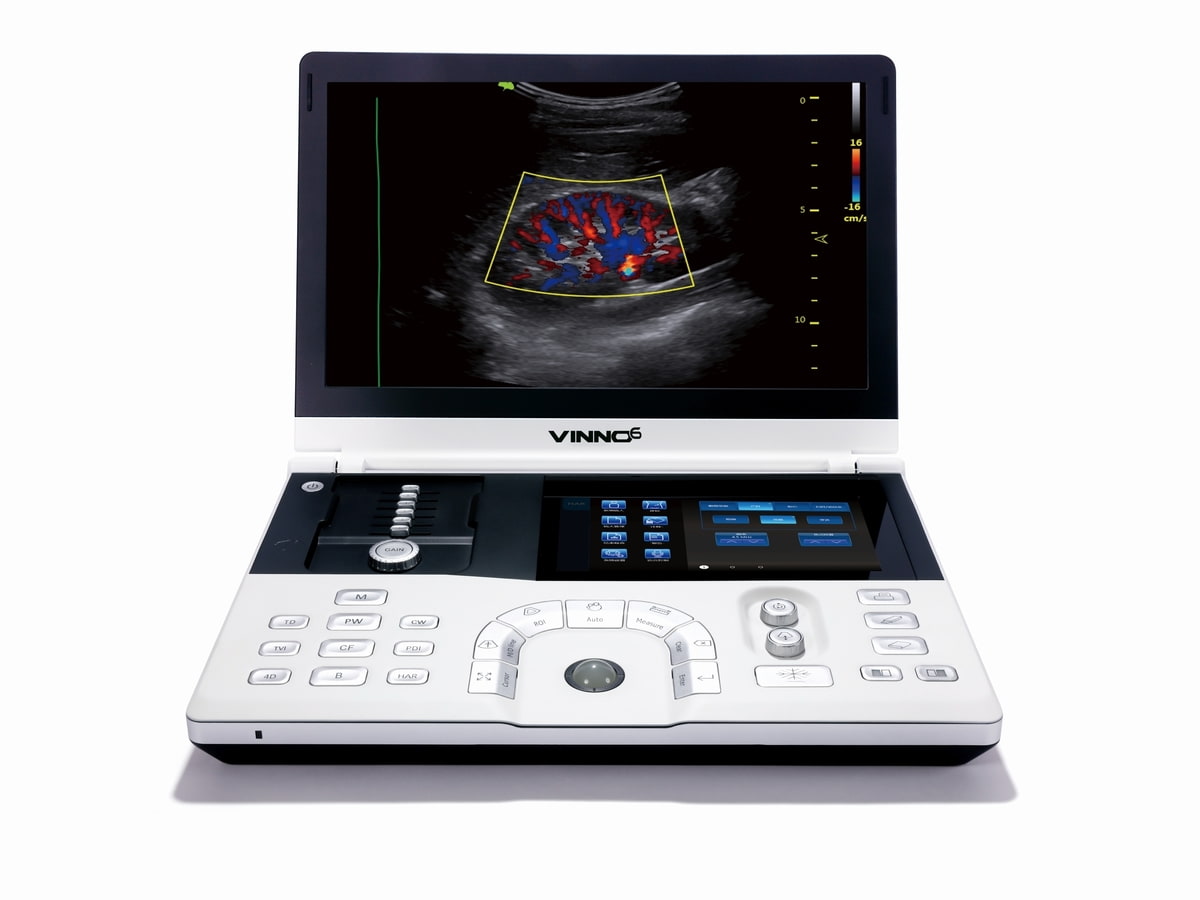 Mobiles Ultraschallgerät VINNO 6 Ansicht von vorne