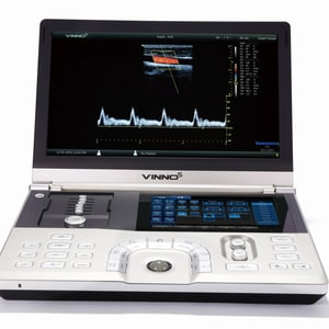 Mobiles Ultraschallgerät VINNO 5 von vorne