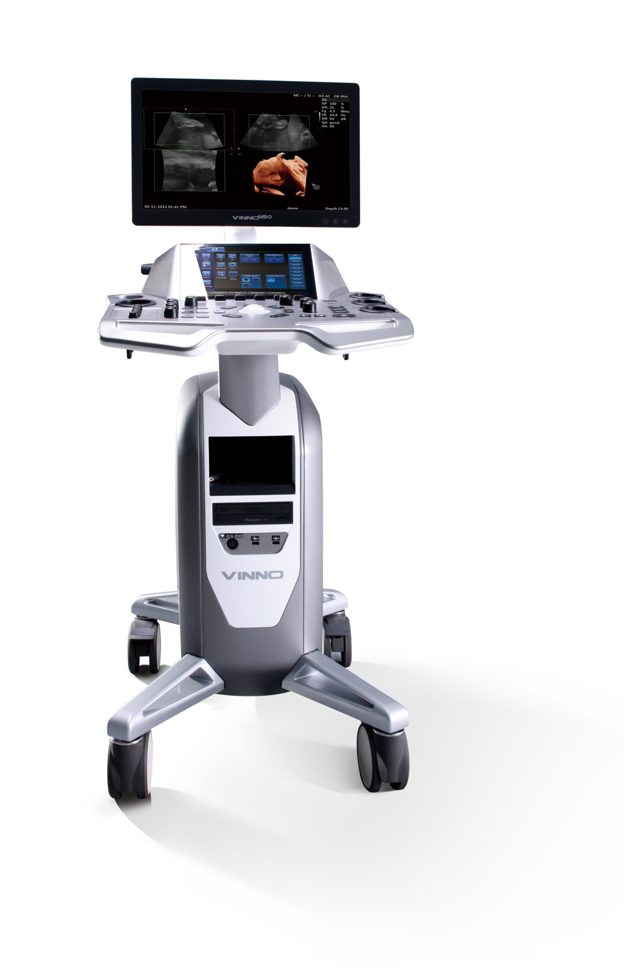 Ultraschallgerät VINNO M50  Ultraschall Diagnostik Gynäkologie
