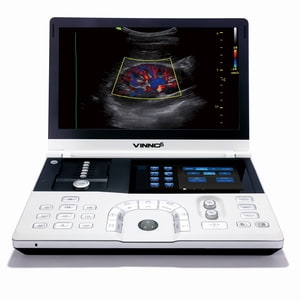 Mobiles Ultraschallgerät VINNO 6 Ansicht von vorne